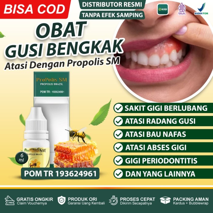 Mengobati penyakit gusi tanpa dokter gigi