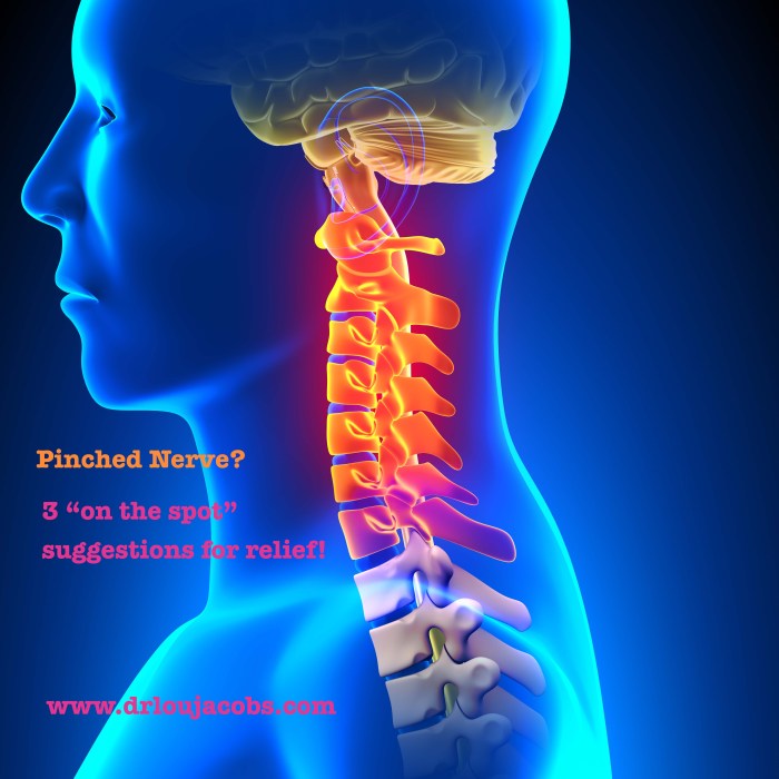 How to sleep with pinched nerve in neck