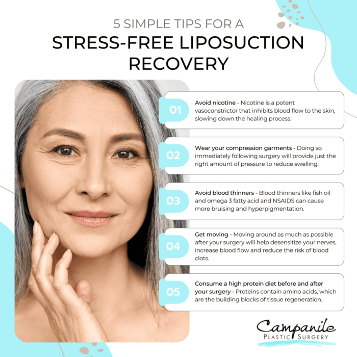 How to get liposuction for free