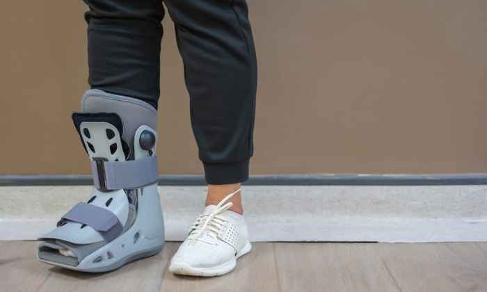 How to walk in a walking boot