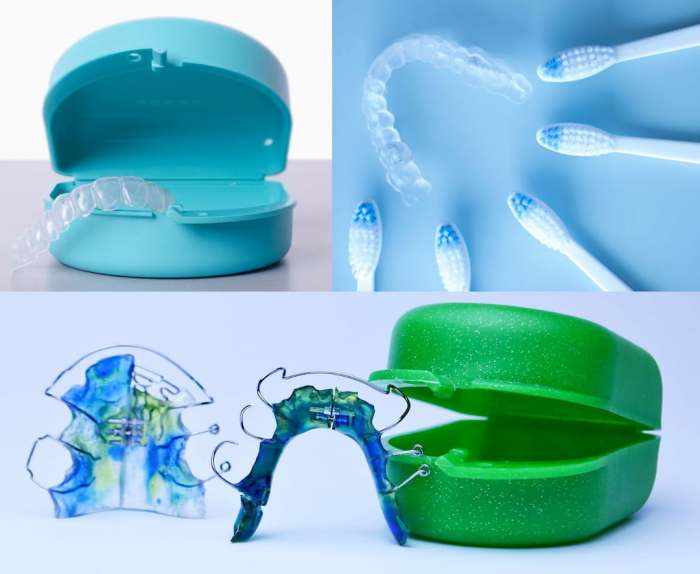 How much do retainers cost to replace