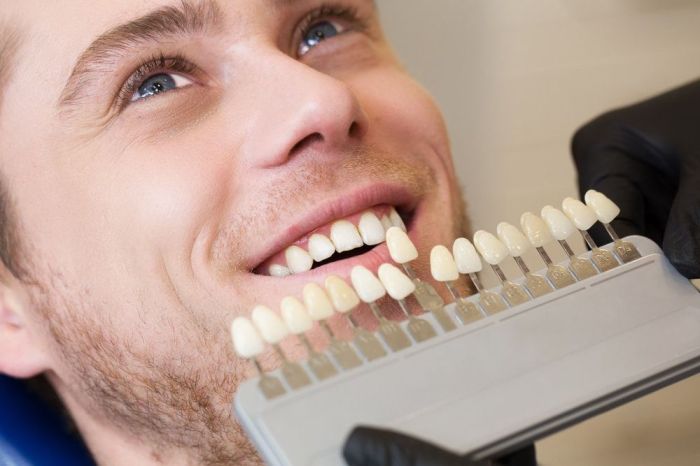 How long does it take to fill in a cavity