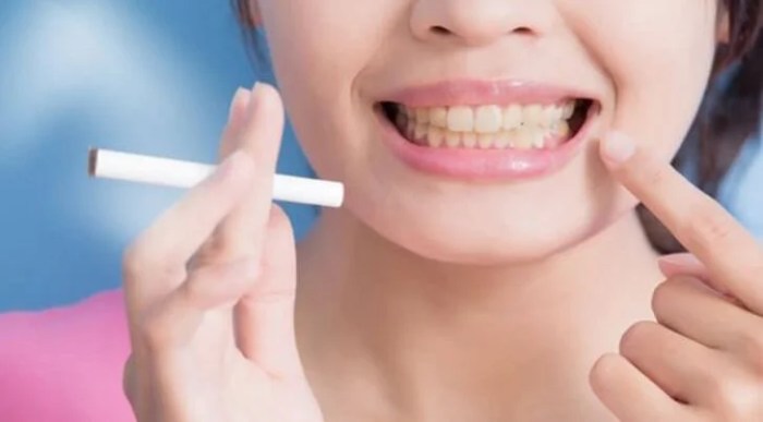 How to prevent dentist from knowing you smoke