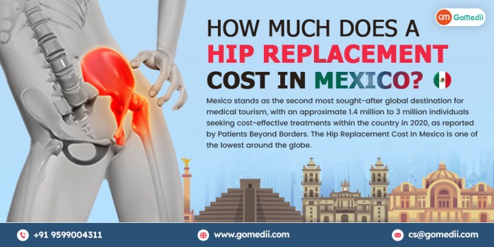 How much does hip replacement cost with insurance