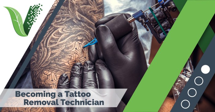 How to become a laser tattoo removal technician