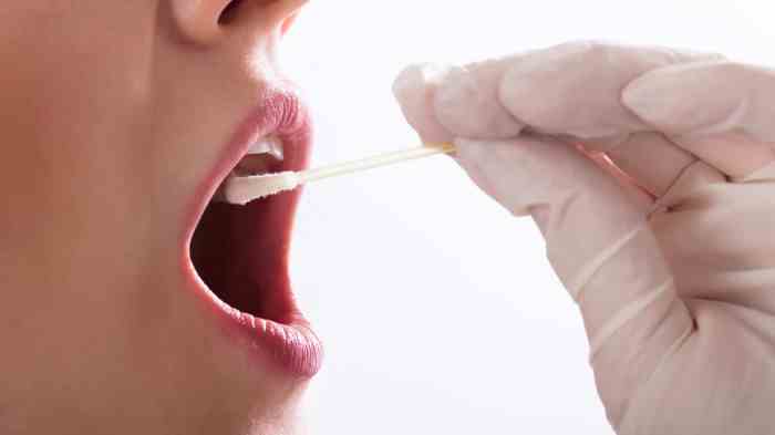 Swab drug Swab drug
