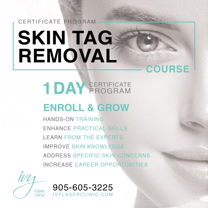 How much does it cost to remove a skin tag