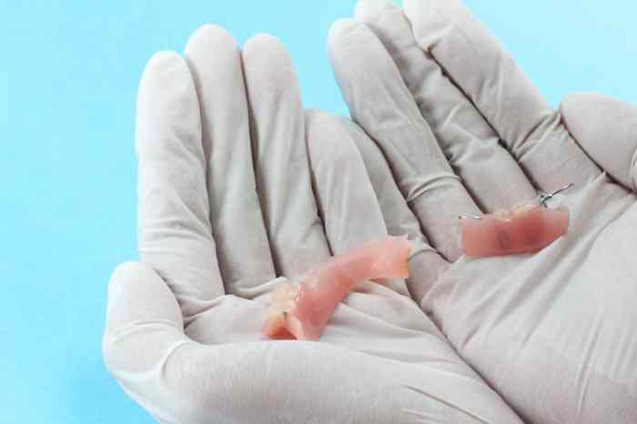 How much does it cost to repair a broken tooth