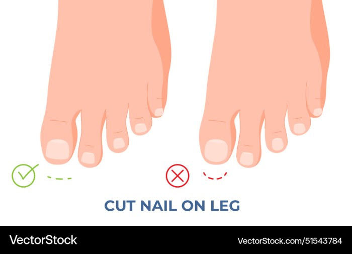 How much does a podiatrist charge to cut toenails