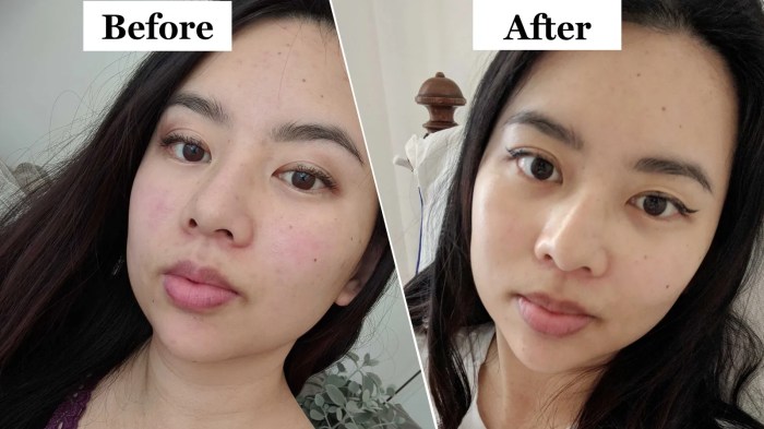 How long does masseter botox take to work