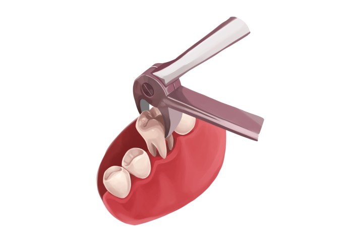 How much does it cost to transfer dental records